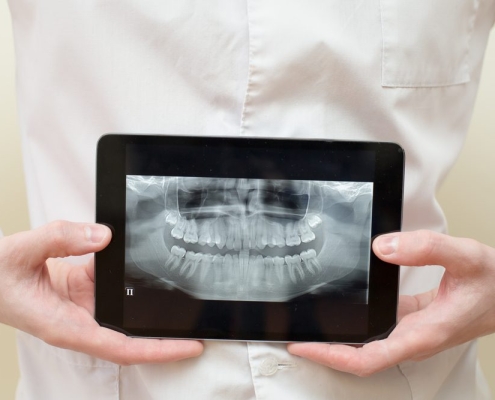 CBCT (Cone Beam Computed Tomography),