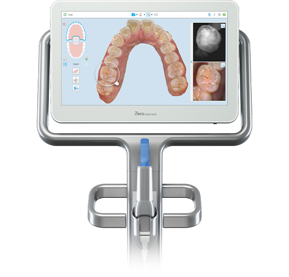 Intraoral Camera